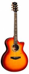 Акустическая гитара цвет Cherry Burst KEPMA B1-GA-BS